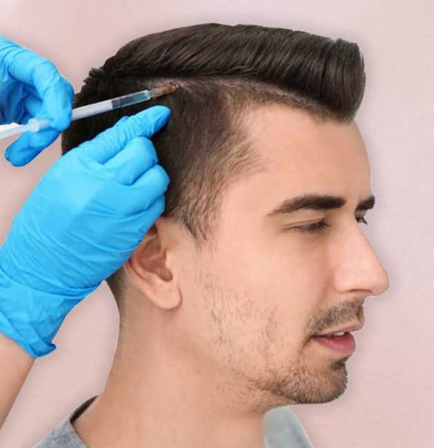 Hair Transplant In Rajkot