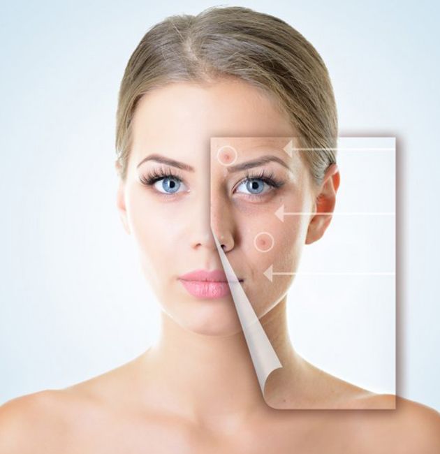 Laser Acne Scar Treatment In Ahmedabad